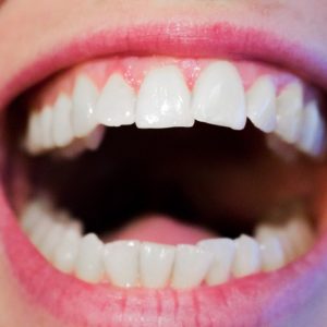 Die 6 wichtigsten Kräuter für die Mundhygiene Die 6 wichtigsten Kräuter für die Mundhygiene